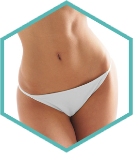 Hexagon crop of the abdomen treatment area for Morpheus8 skin remodelling in Amsterdam